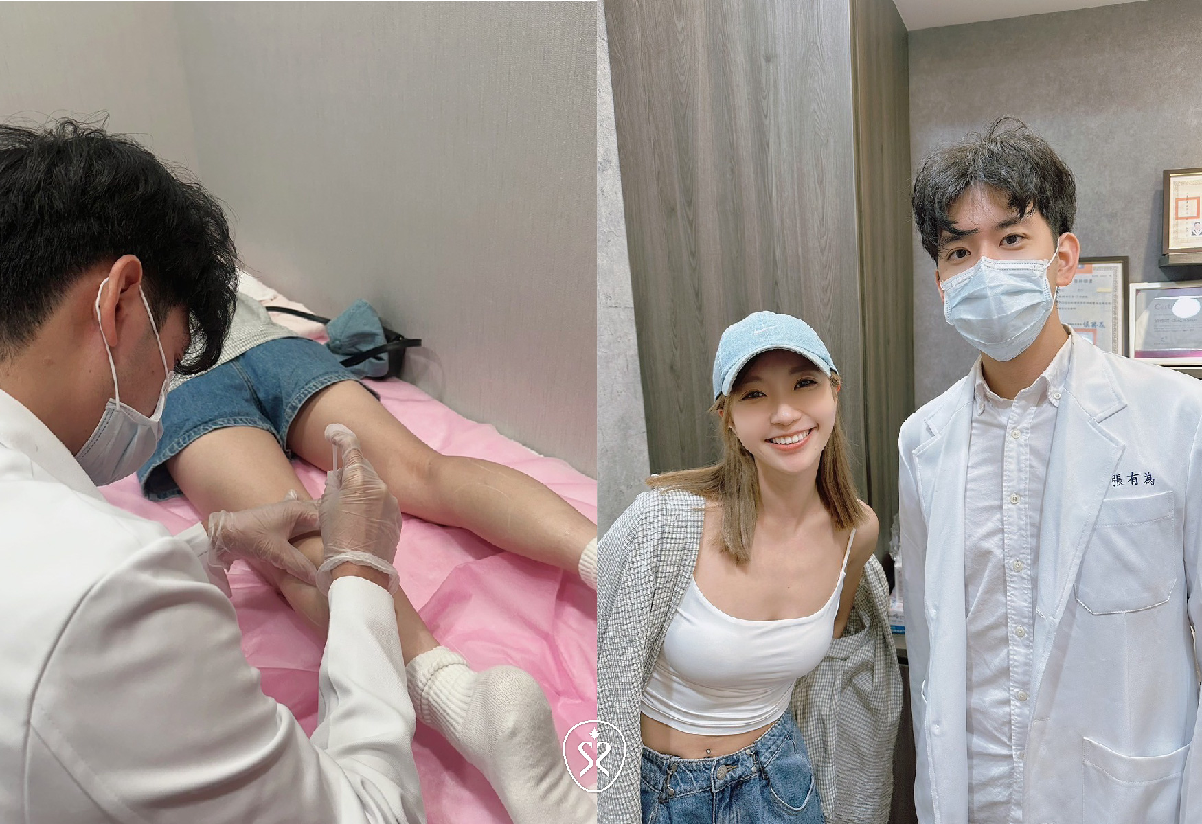 自強星和診所竹北-肉毒小腿改善腫脹線條